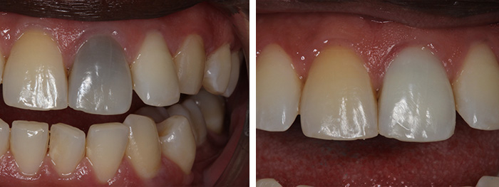 Dental Smile Gallery