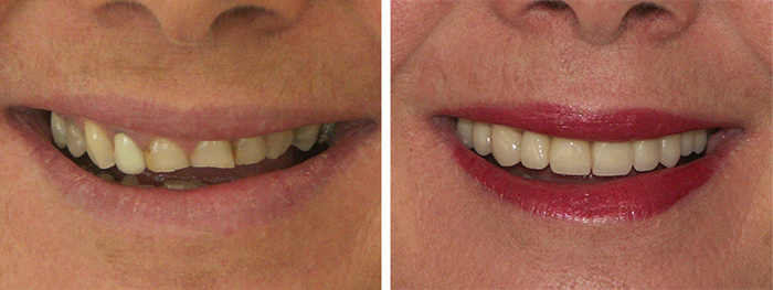 Dental Smile Gallery