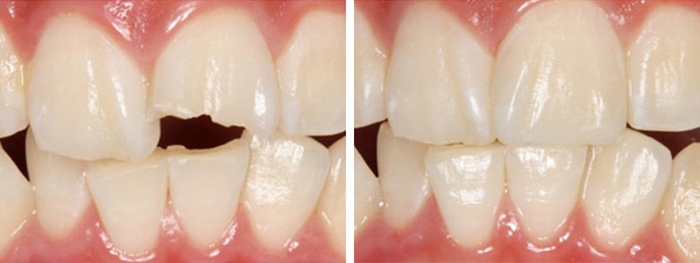 Dental Smile Gallery