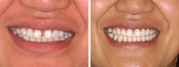 Dental Smile Gallery