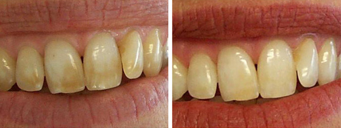 Dental Smile Gallery