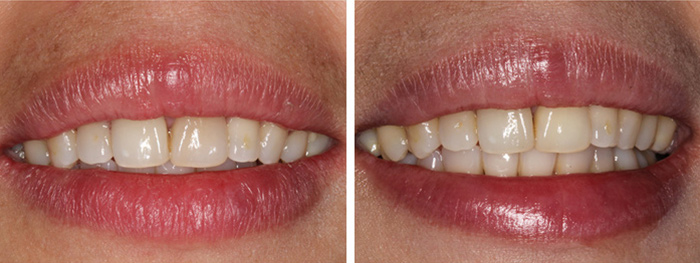 Dental Smile Gallery